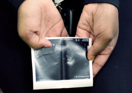 Texas Bishops Applaud Supreme Court Ruling on Abortion Law