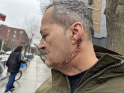 Caretaker Viciously Slashed by Belligerent Attacker Outside East Village Church