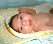 Family Finds Purpose, Joy Caring For Daughter With Rare Condition 